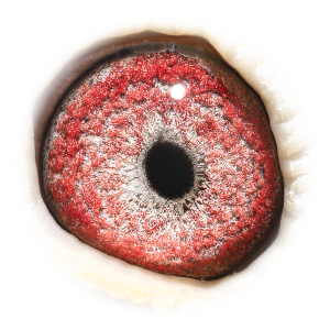 眼睛 杨回血直孙X奥林匹克03回血直孙女